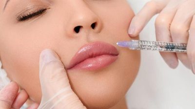 دکتر تزریق ژل در زنجان