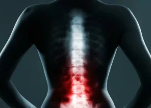دیسک کمر خفیف را چگونه درمان کنیم؟